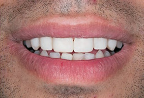 dental images 33015